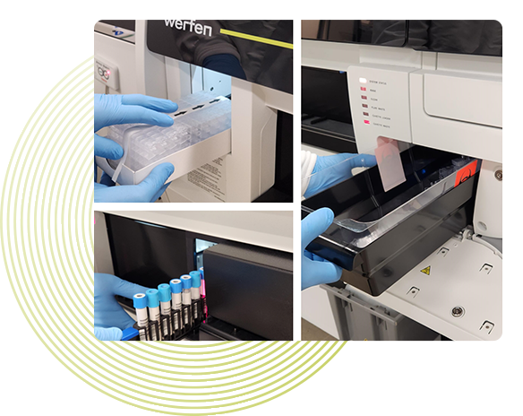 Photo comprises 3 images showing a laboratorian's hands wearing blue gloves and loading into a Werfen ACL TOP Family 70 Series analyzer cuvettes, samples, and reagents to demonstrate that this can be done at any time, with no system interruption or downtime.